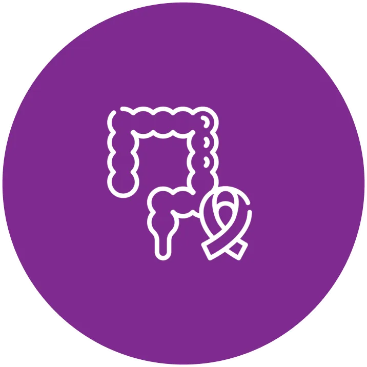 Colon Cancer